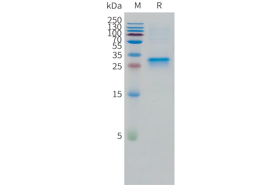 SDS-PAGE - Recombinant Human Oncostatin M/OSM Protein (C-terminal 10xHis Tag) (A332863) - Antibodies.com