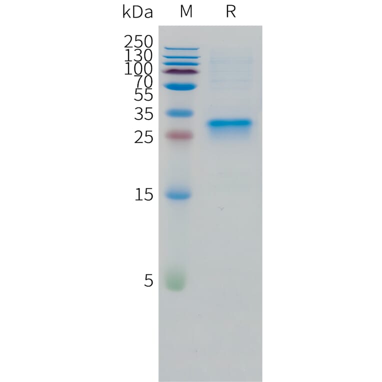 SDS-PAGE - Recombinant Human Oncostatin M/OSM Protein (C-terminal 10xHis Tag) (A332863) - Antibodies.com
