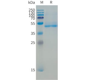 SDS-PAGE - Recombinant Human B4GALT1 Protein (N-terminal 10xHis Tag) (A332864) - Antibodies.com