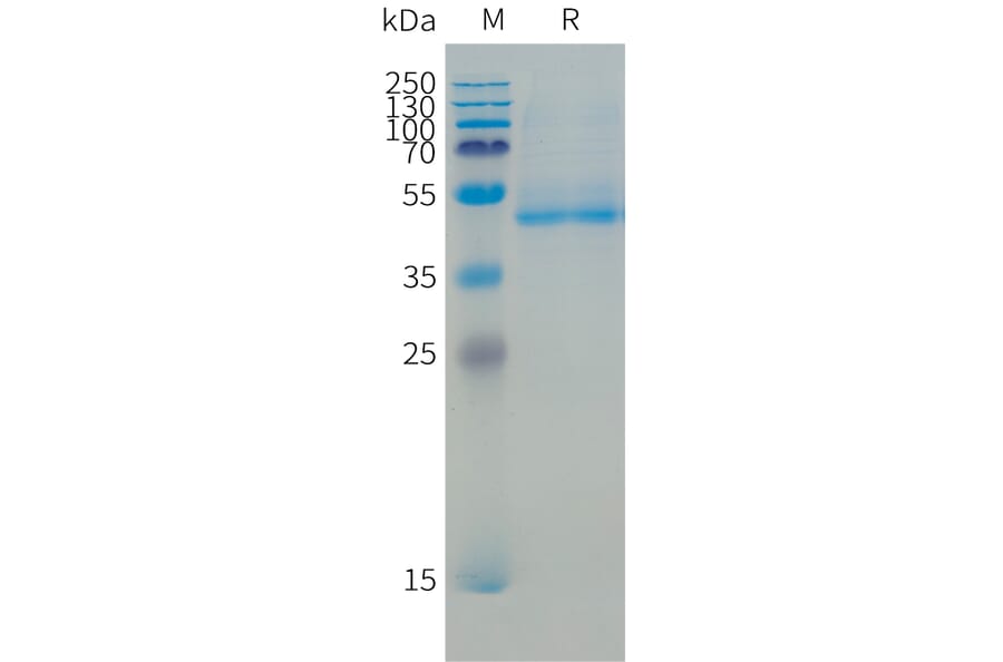 SDS-PAGE - Recombinant Human B4GALT1 Protein (N-terminal 10xHis Tag) (A332864) - Antibodies.com