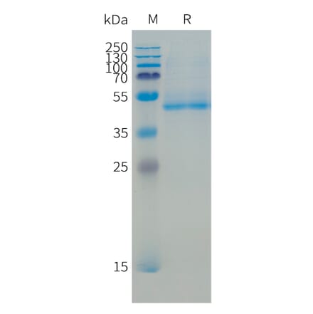 SDS-PAGE - Recombinant Human B4GALT1 Protein (N-terminal 10xHis Tag) (A332864) - Antibodies.com