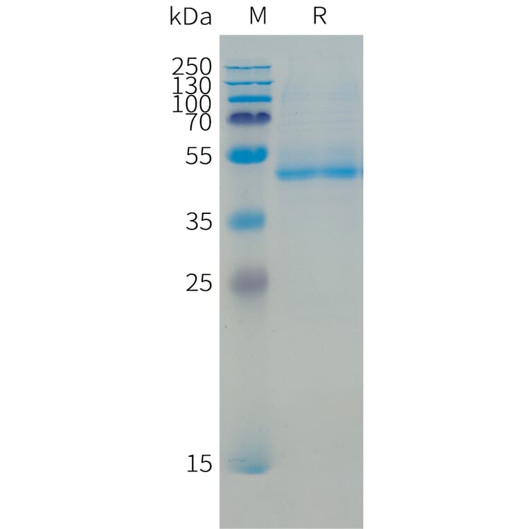 SDS-PAGE - Recombinant Human B4GALT1 Protein (N-terminal 10xHis Tag) (A332864) - Antibodies.com