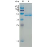 SDS-PAGE - Recombinant Human B4GALT1 Protein (N-terminal 10xHis Tag) (A332864) - Antibodies.com