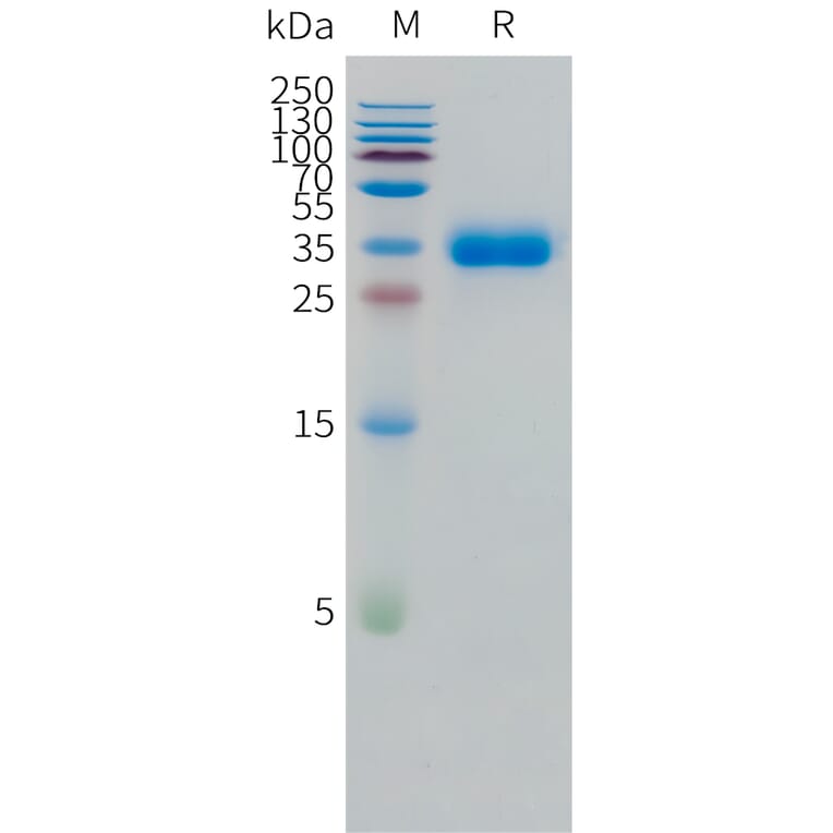 SDS-PAGE - Recombinant Human CD2 Protein (C-terminal 10xHis Tag) (A332865) - Antibodies.com