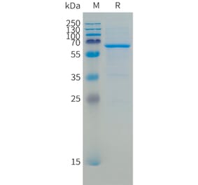 SDS-PAGE - Recombinant Human CD73 Protein (C-terminal 10xHis Tag) (A332866) - Antibodies.com