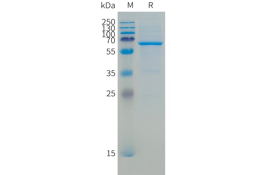 SDS-PAGE - Recombinant Human CD73 Protein (C-terminal 10xHis Tag) (A332866) - Antibodies.com