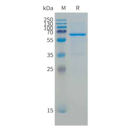SDS-PAGE - Recombinant Human CD73 Protein (C-terminal 10xHis Tag) (A332866) - Antibodies.com