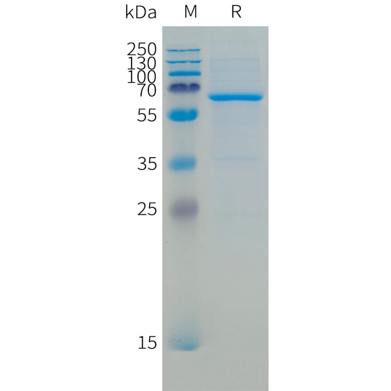 SDS-PAGE - Recombinant Human CD73 Protein (C-terminal 10xHis Tag) (A332866) - Antibodies.com