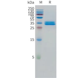 SDS-PAGE - Recombinant Human GPA33 Protein (C-terminal 10xHis Tag) (A332867) - Antibodies.com