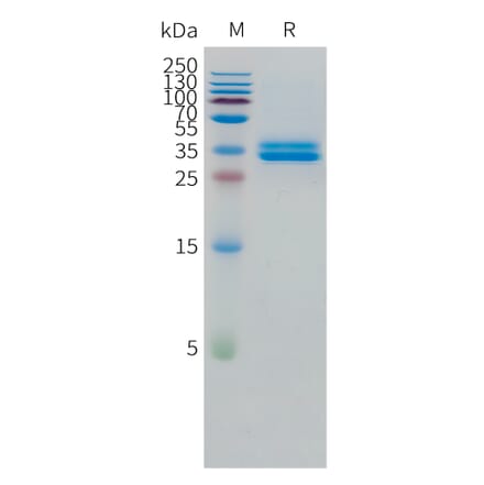 SDS-PAGE - Recombinant Human GPA33 Protein (C-terminal 10xHis Tag) (A332867) - Antibodies.com