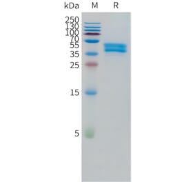 SDS-PAGE - Recombinant Human OR1A1 Protein (C-terminal hFc Tag) (A332868) - Antibodies.com