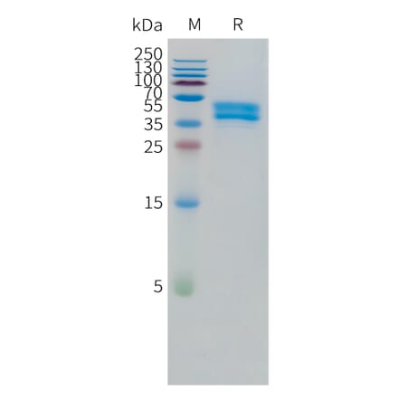 SDS-PAGE - Recombinant Human OR1A1 Protein (C-terminal hFc Tag) (A332868) - Antibodies.com