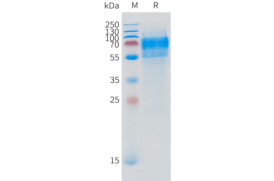 SDS-PAGE - Recombinant Human DPEP3 Protein (C-terminal 10xHis Tag) (A332870) - Antibodies.com
