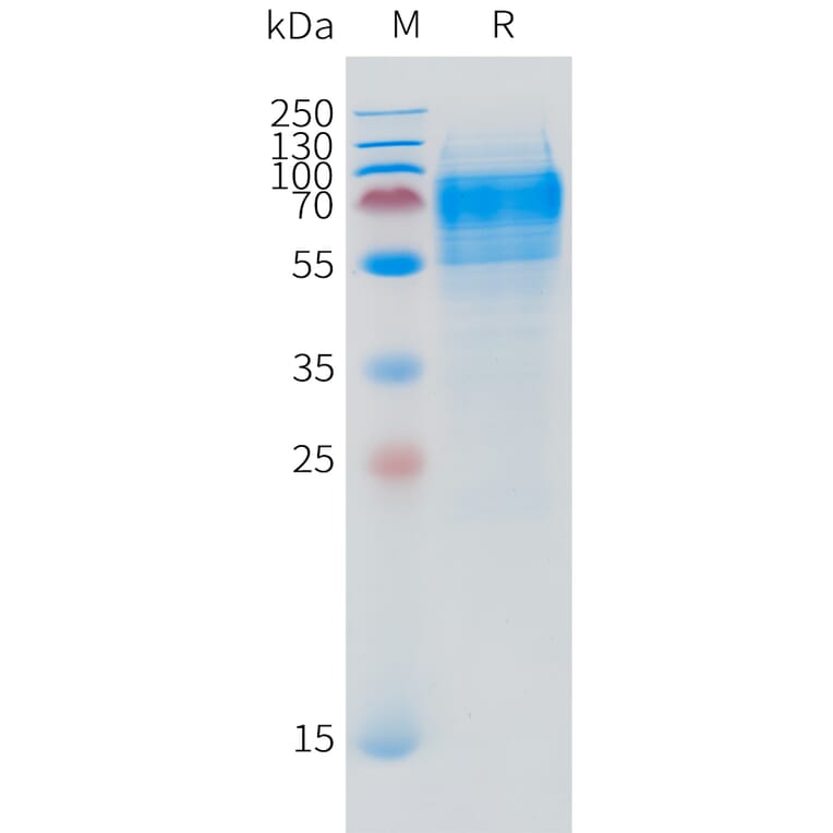 SDS-PAGE - Recombinant Human DPEP3 Protein (C-terminal 10xHis Tag) (A332870) - Antibodies.com