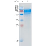 SDS-PAGE - Recombinant Human DPEP3 Protein (C-terminal 10xHis Tag) (A332870) - Antibodies.com