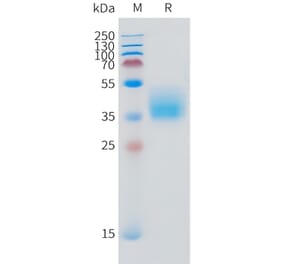 SDS-PAGE - Recombinant Human IFNGR1 Protein (C-terminal 10xHis Tag) (A332871) - Antibodies.com