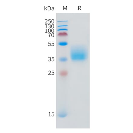 SDS-PAGE - Recombinant Human IFNGR1 Protein (C-terminal 10xHis Tag) (A332871) - Antibodies.com