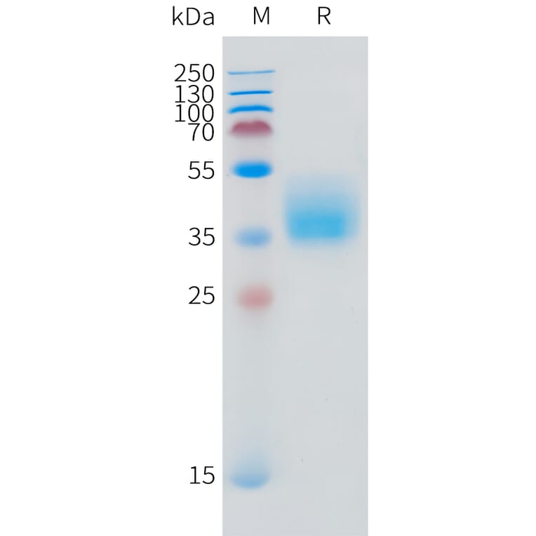 SDS-PAGE - Recombinant Human IFNGR1 Protein (C-terminal 10xHis Tag) (A332871) - Antibodies.com