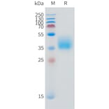 SDS-PAGE - Recombinant Human IFNGR1 Protein (C-terminal 10xHis Tag) (A332871) - Antibodies.com