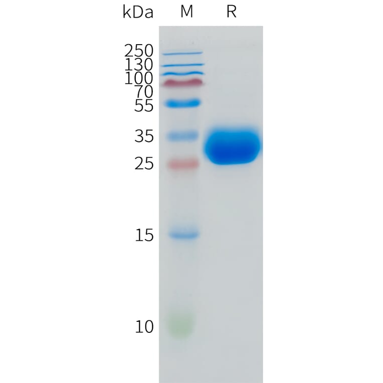 SDS-PAGE - Recombinant Human LAMP5 Protein (C-terminal 10xHis Tag) (A332872) - Antibodies.com