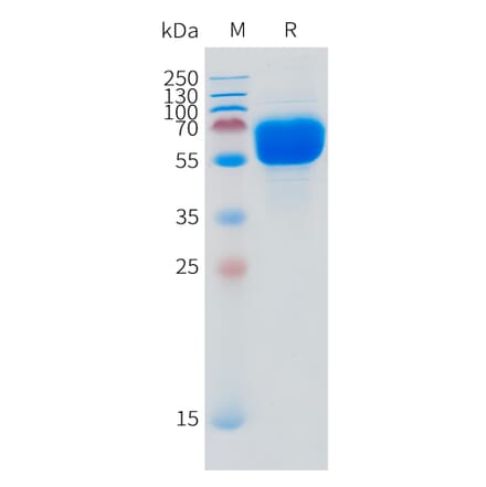 SDS-PAGE - Recombinant Human SLC44A4 Protein (N-terminal hFc Tag) (A332873) - Antibodies.com