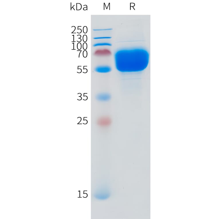 SDS-PAGE - Recombinant Human SLC44A4 Protein (N-terminal hFc Tag) (A332873) - Antibodies.com