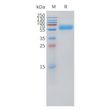 SDS-PAGE - Recombinant Human PTH1R Protein (C-terminal hFc Tag) (A332875) - Antibodies.com