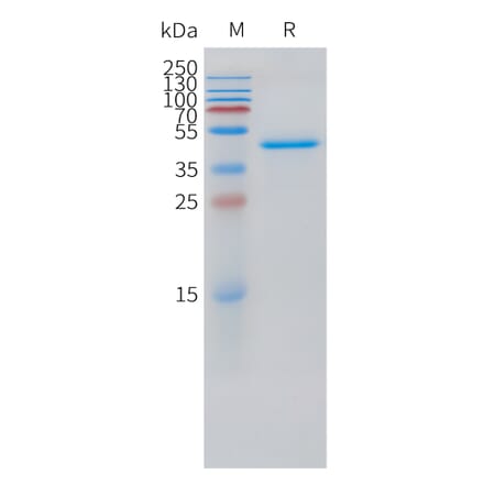 SDS-PAGE - Recombinant Human VEGFD Protein (C-terminal hFc Tag) (A332876) - Antibodies.com