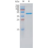 SDS-PAGE - Recombinant Human VEGFD Protein (C-terminal hFc Tag) (A332876) - Antibodies.com