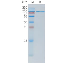 SDS-PAGE - Recombinant Human TSHR Protein (N-terminal hFc Tag) (A332878) - Antibodies.com
