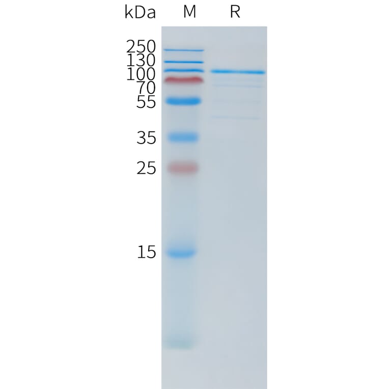 SDS-PAGE - Recombinant Human TSHR Protein (N-terminal hFc Tag) (A332878) - Antibodies.com