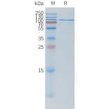 SDS-PAGE - Recombinant Human TSHR Protein (N-terminal hFc Tag) (A332878) - Antibodies.com