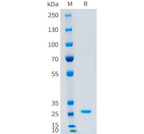 SDS-PAGE - Recombinant Human CFD Protein (C-terminal 10xHis Tag) (A332879) - Antibodies.com