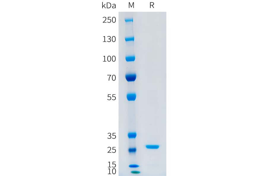 SDS-PAGE - Recombinant Human CFD Protein (C-terminal 10xHis Tag) (A332879) - Antibodies.com