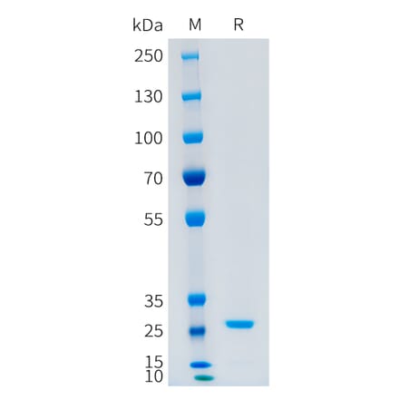SDS-PAGE - Recombinant Human CFD Protein (C-terminal 10xHis Tag) (A332879) - Antibodies.com