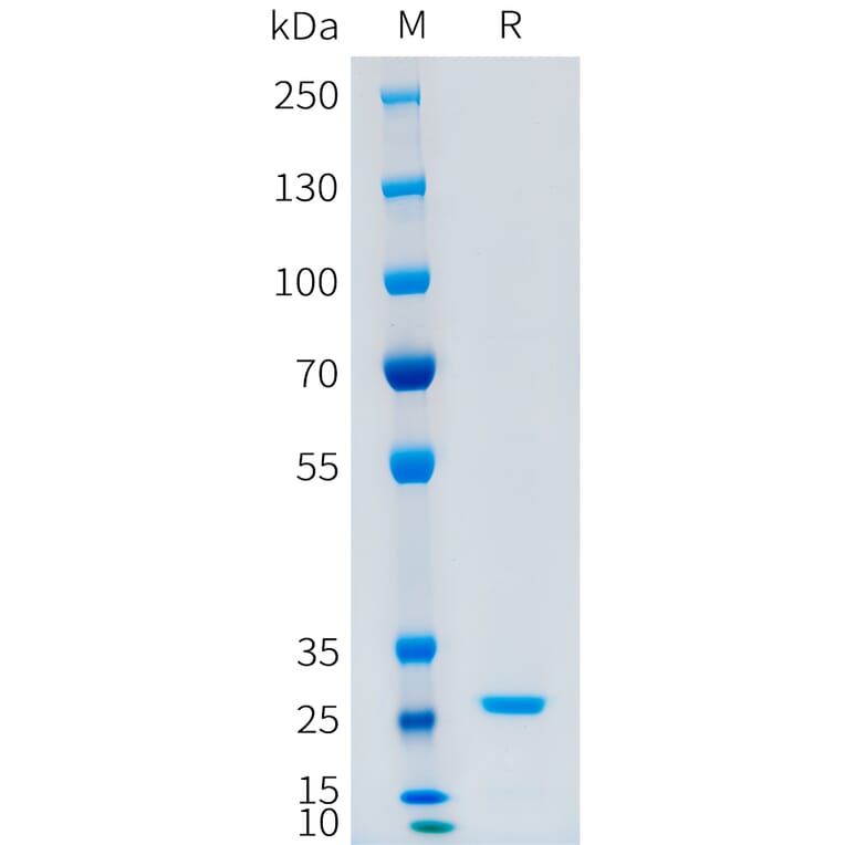SDS-PAGE - Recombinant Human CFD Protein (C-terminal 10xHis Tag) (A332879) - Antibodies.com