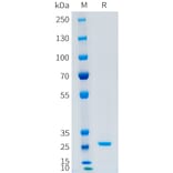 SDS-PAGE - Recombinant Human CFD Protein (C-terminal 10xHis Tag) (A332879) - Antibodies.com