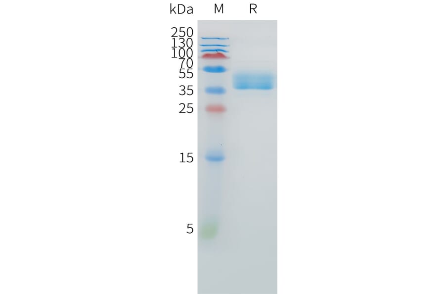 SDS-PAGE - Recombinant Human EDNRB Protein (C-terminal hFc Tag) (A332880) - Antibodies.com