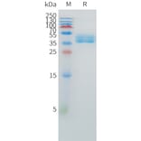 SDS-PAGE - Recombinant Human EDNRB Protein (C-terminal hFc Tag) (A332880) - Antibodies.com
