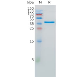 SDS-PAGE - Recombinant Human SPARC Protein (C-terminal 10xHis Tag) (A332881) - Antibodies.com