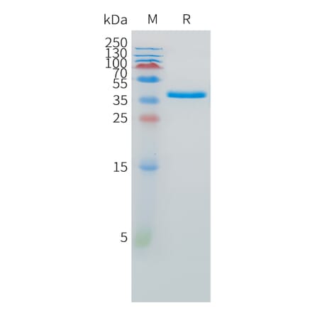 SDS-PAGE - Recombinant Human SPARC Protein (C-terminal 10xHis Tag) (A332881) - Antibodies.com