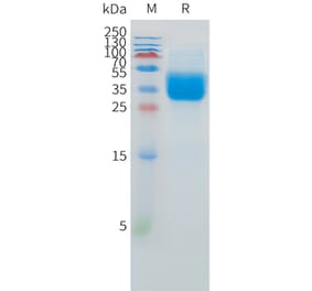 SDS-PAGE - Recombinant Human IFNAR2 Protein (C-terminal 10xHis Tag) (A332882) - Antibodies.com