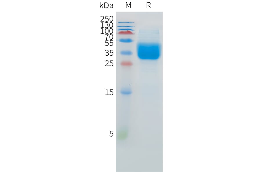 SDS-PAGE - Recombinant Human IFNAR2 Protein (C-terminal 10xHis Tag) (A332882) - Antibodies.com