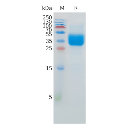 SDS-PAGE - Recombinant Human IFNAR2 Protein (C-terminal 10xHis Tag) (A332882) - Antibodies.com