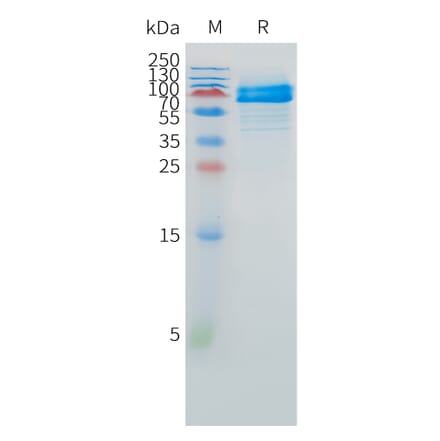SDS-PAGE - Recombinant Human FCRL1 Protein (C-terminal hFc Tag) (A332883) - Antibodies.com