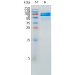 SDS-PAGE - Recombinant Human FCRL1 Protein (C-terminal hFc Tag) (A332883) - Antibodies.com