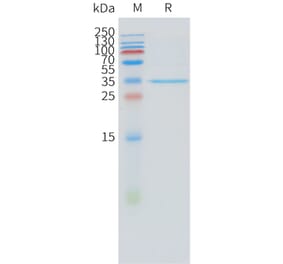SDS-PAGE - Recombinant Human STEAP1 Protein (N-terminal hFc Tag) (A332884) - Antibodies.com