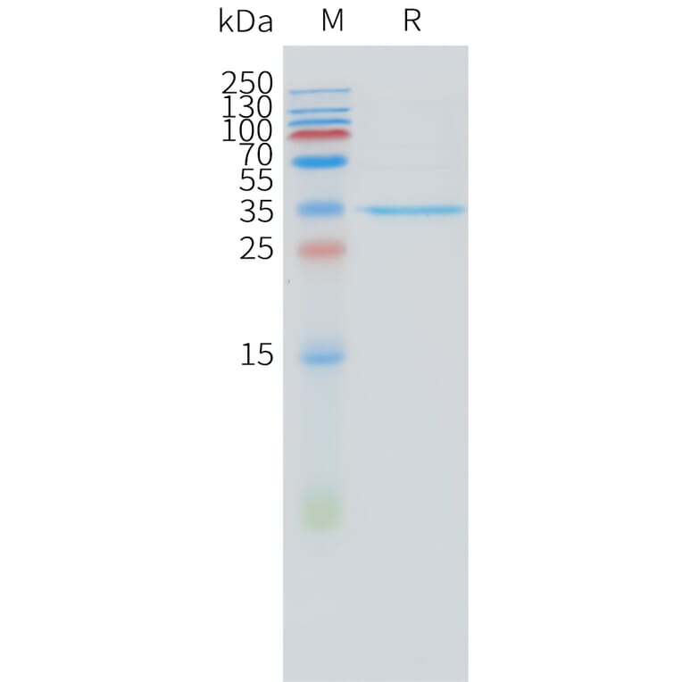 SDS-PAGE - Recombinant Human STEAP1 Protein (N-terminal hFc Tag) (A332884) - Antibodies.com