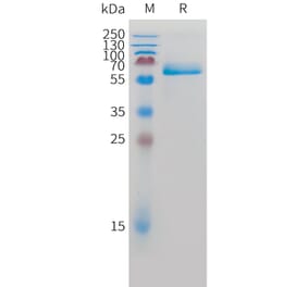 SDS-PAGE - Recombinant Human Intestinal Alkaline Phosphatase Protein (C-terminal 10xHis Tag) (A332885) - Antibodies.com