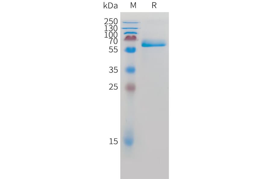 SDS-PAGE - Recombinant Human Intestinal Alkaline Phosphatase Protein (C-terminal 10xHis Tag) (A332885) - Antibodies.com
